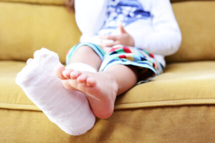 Fracturas  - Excelente Atención Pediátrica de Urgencia en Texas - Clínicas Little Spurs de Atención Pediátrica de Urgencia