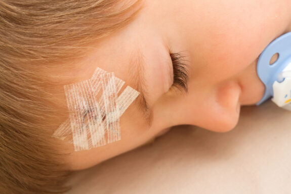 A Parent’s Guide to Deciding If Their Child Needs Stitches - 