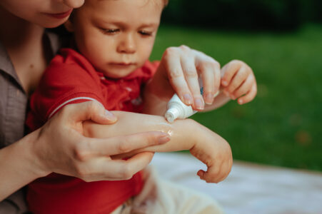 FAQs on Insect Bites in Kids - Premier Pediatric Urgent Care Provider in Texas - Little Spurs Pediatric Urgent Care