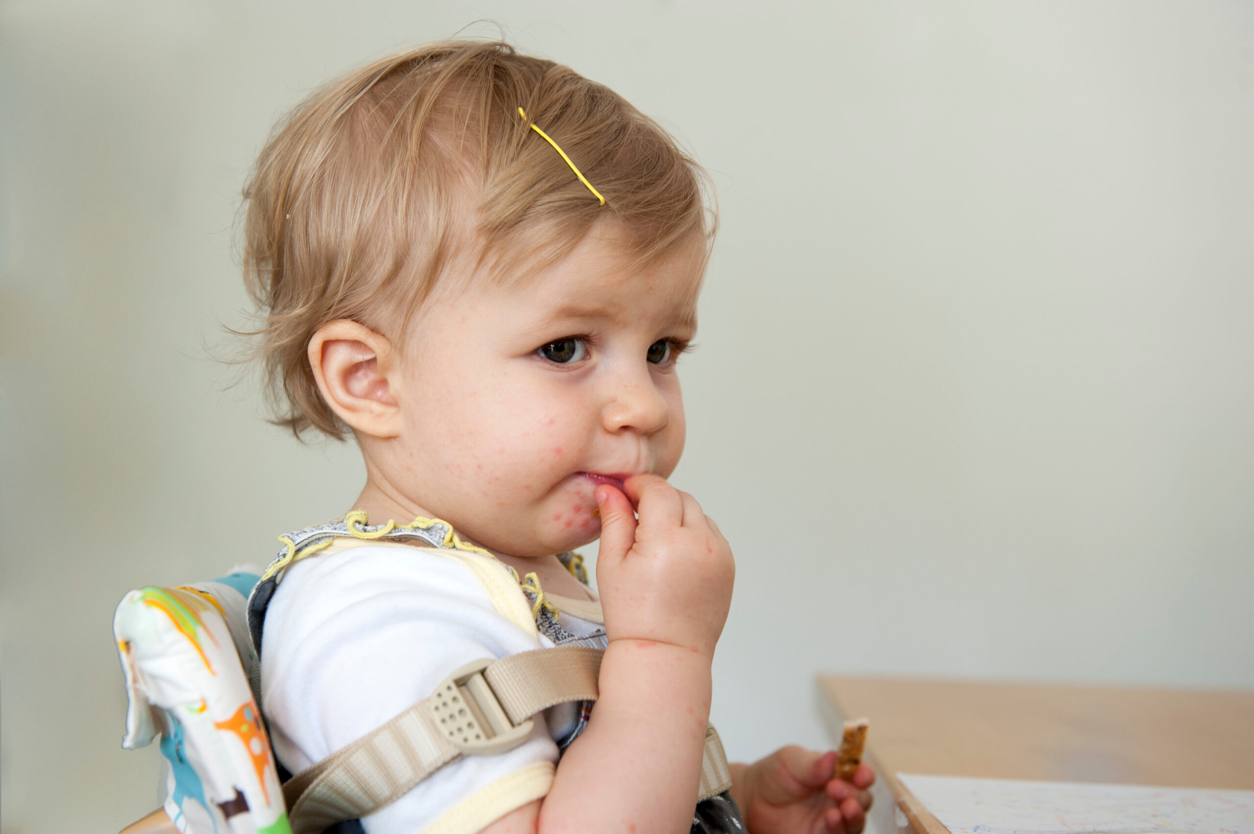 Hand Foot and Mouth Disease: How to Help Your Child - Premier Pediatric Urgent Care Provider in Texas - Little Spurs Pediatric Urgent Care